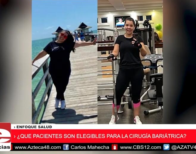 the-bariatric-metabolic-institute-at-gsmc-is-profiled-on-azteca-america-tv-659x519